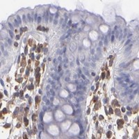 HPA IHC Colon — ABCC1