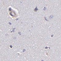 HPA IHC Cerebral cortex — ABCC1