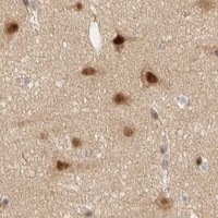 HPA IHC Cerebral cortex — SIK1