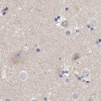 HPA IHC Cerebral cortex — MSRA