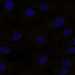 HPA023908: hTERT-RPE1 (serum starved)