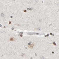 HPA IHC Cerebral cortex — TRAM1