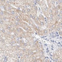 HPA IHC Liver — ATP6V1C1