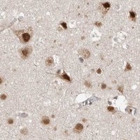 HPA IHC Cerebral cortex — EIF3E