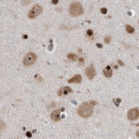 HPA IHC Cerebral cortex — NCL