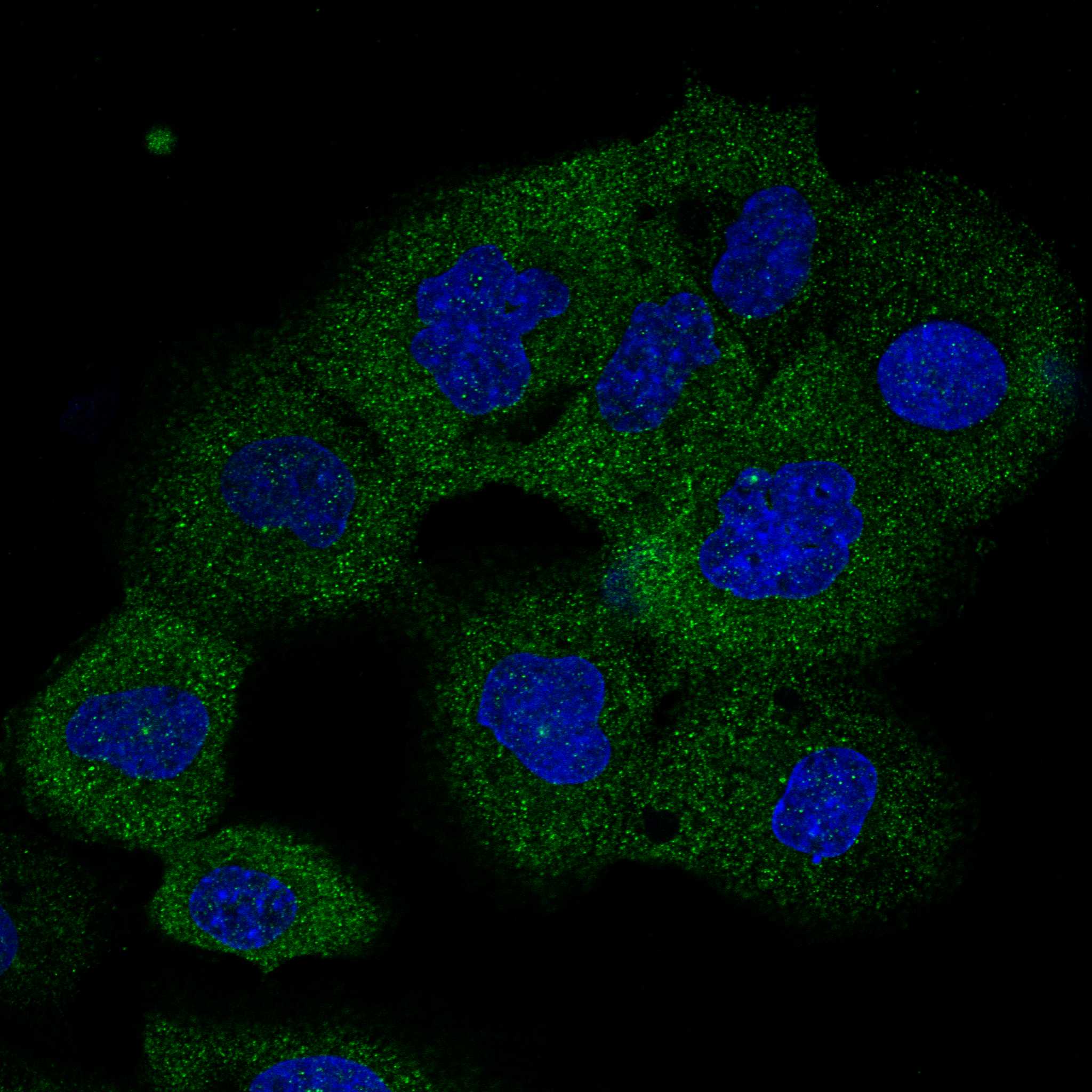 Subcellular ALOX12B The Human Protein Atlas