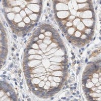 HPA IHC Colon — SUMF2