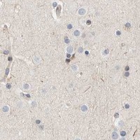 HPA IHC Cerebral cortex — SUMF2
