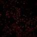 HPA024120: U-2 OS, siRNA 2 (10x)