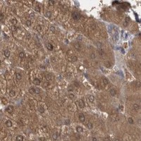 HPA IHC Liver — DDX6