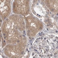 HPA IHC Kidney — DDX6
