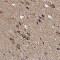 HPA IHC Cerebral cortex — DDX6