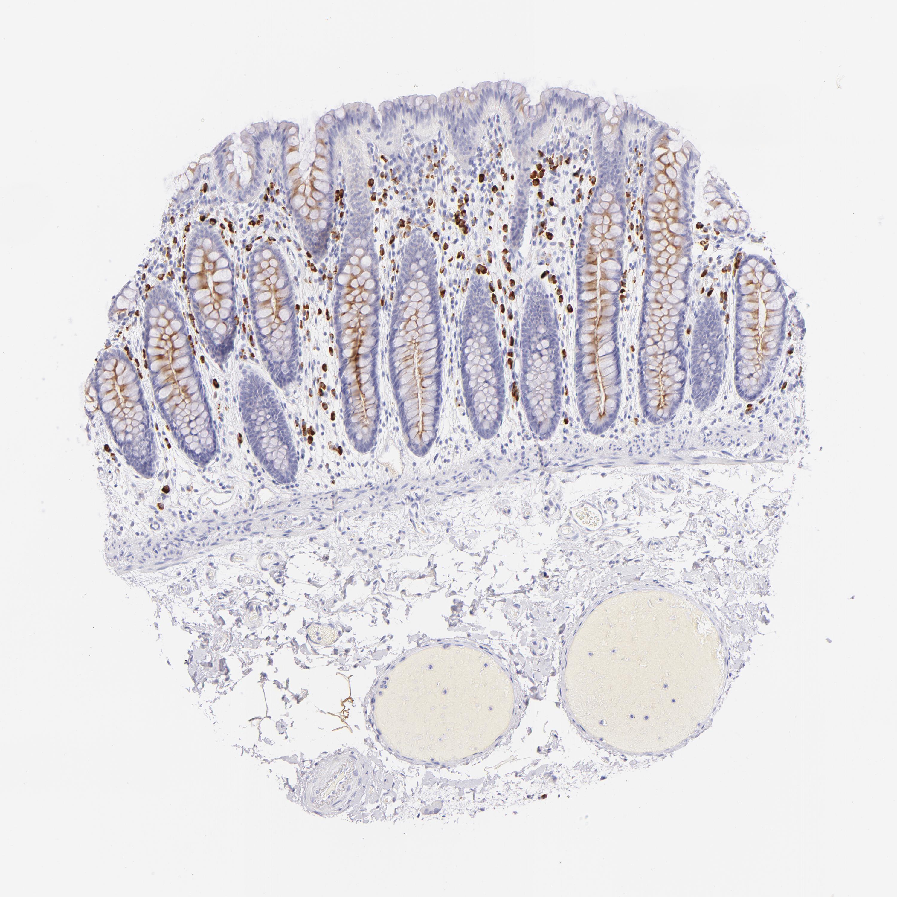 Tissue expression of SDC1 Staining in colon The Human Protein Atlas