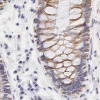 HPA IHC Colon — OTC