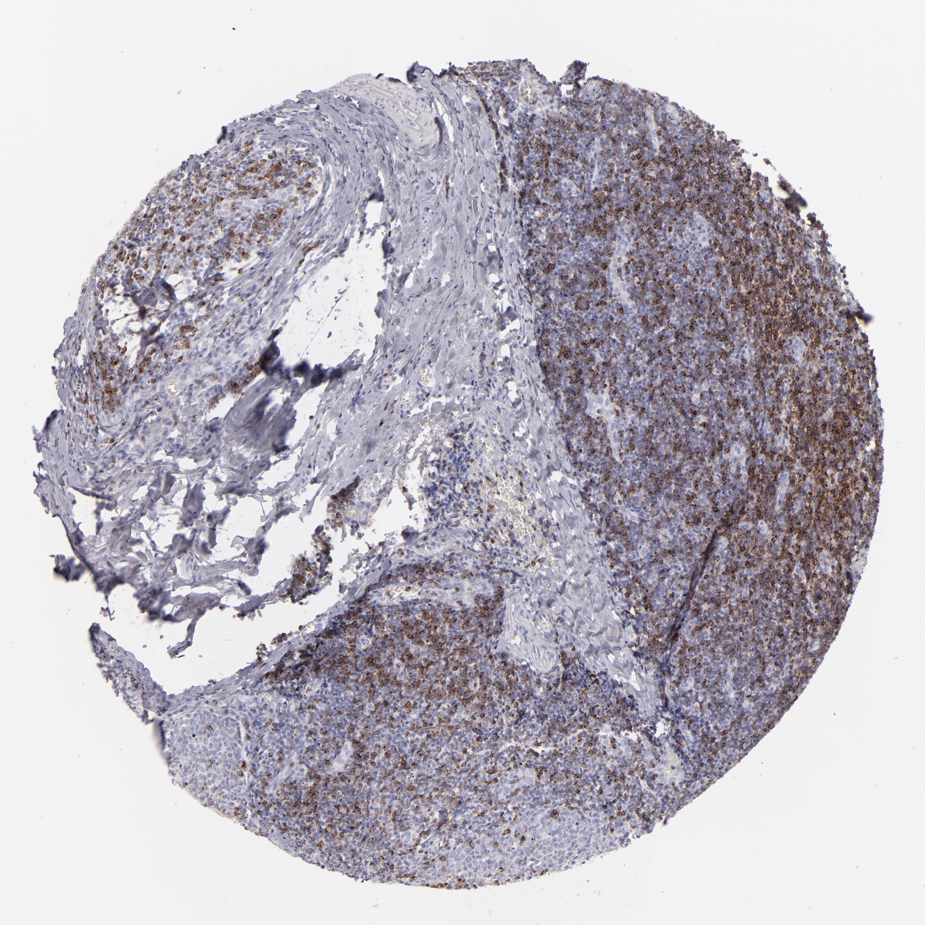 Tissue expression of CD2 Staining in tonsil The Human Protein Atlas