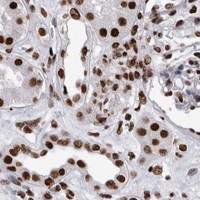 HPA IHC Kidney — HNRNPM