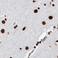 HPA IHC Cerebral cortex — HNRNPM