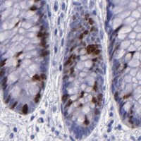 HPA IHC Colon — TOP2A