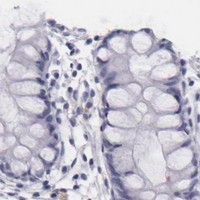 HPA IHC Colon — TNNC1