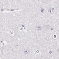 HPA IHC Cerebral cortex — TNNC1