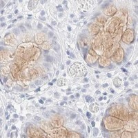 HPA IHC Colon — KRT15