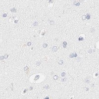 HPA IHC Cerebral cortex — KRT15