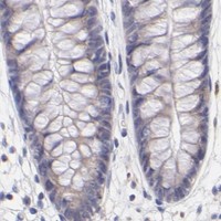 HPA IHC Colon — GCSAM
