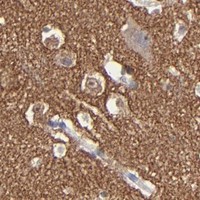 HPA IHC Cerebral cortex — RPH3A