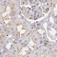 HPA IHC Kidney — ABCC4