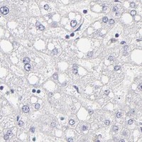 HPA IHC Liver — ABCC4