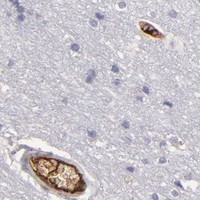 HPA IHC Cerebral cortex — ABCC4