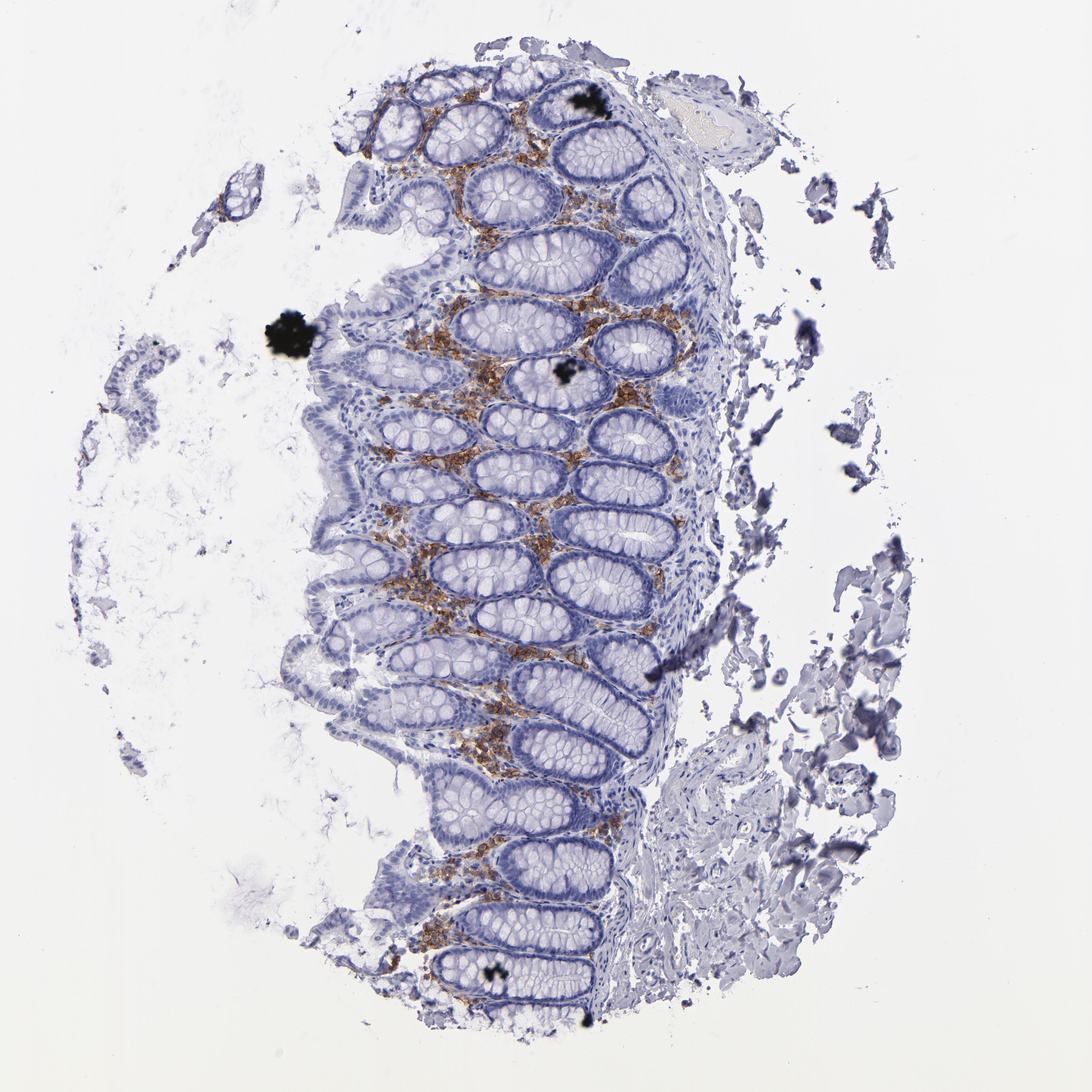 ◆colon◆ Tissue expression of CD38 - Staining in colon - The Human