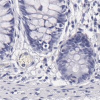 HPA IHC Colon — GP1BA