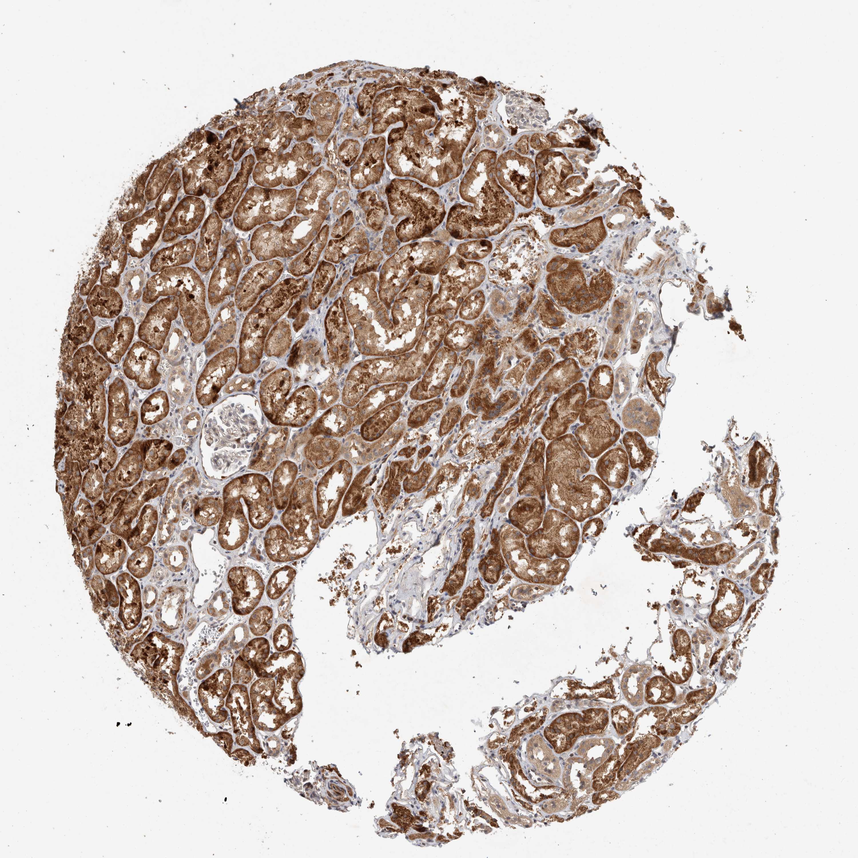 Tissue expression of INSRR Staining in kidney The Human Protein Atlas