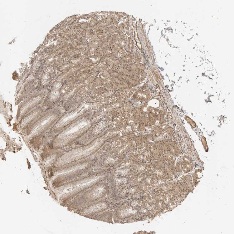 Tissue expression of KEAP1 Staining in stomach The Human Protein Atlas