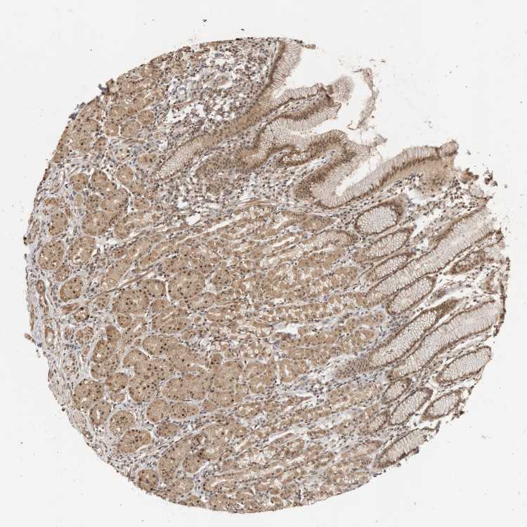 Tissue expression of KEAP1 Staining in stomach The Human Protein Atlas