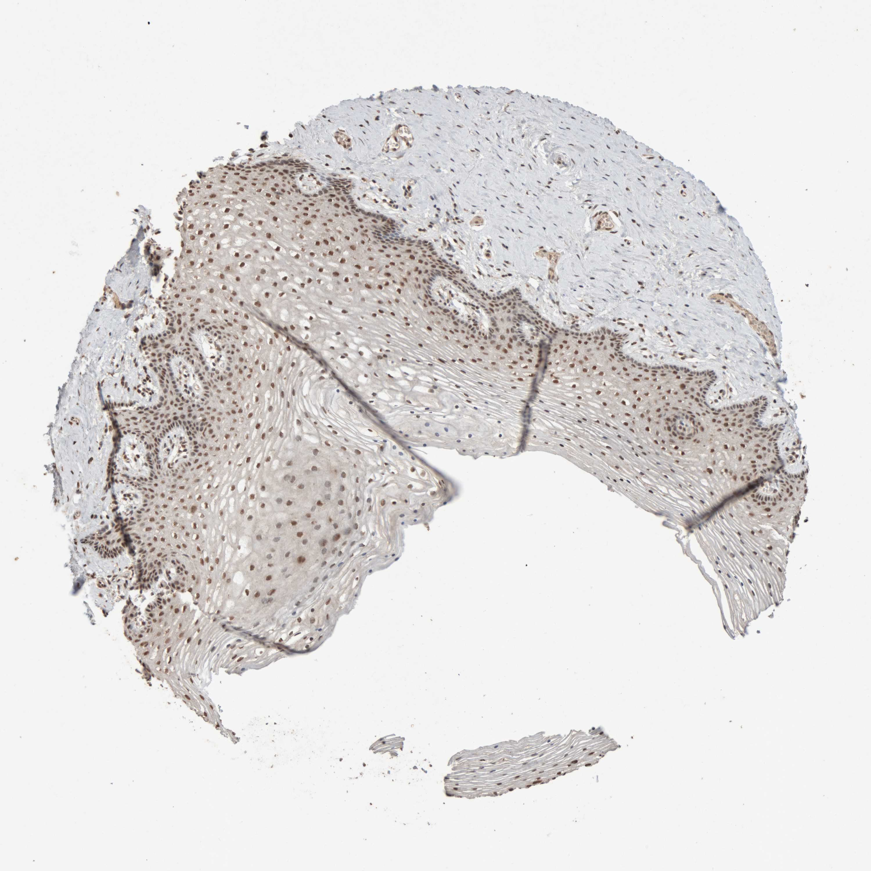 Tissue expression of KEAP1 Staining in vagina The Human Protein Atlas