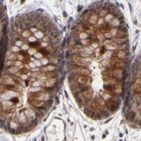 HPA IHC Colon — HUWE1