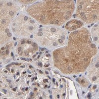 HPA IHC Kidney — HUWE1