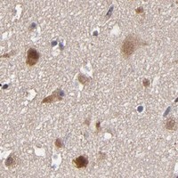 HPA IHC Cerebral cortex — HUWE1