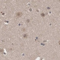 HPA IHC Cerebral cortex — SOCS5