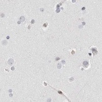 HPA IHC Cerebral cortex — CASP7