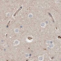 HPA IHC Cerebral cortex — ERAP2