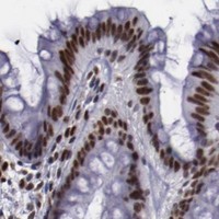 HPA IHC Colon — APEX1