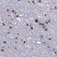 HPA IHC Cerebral cortex — APEX1