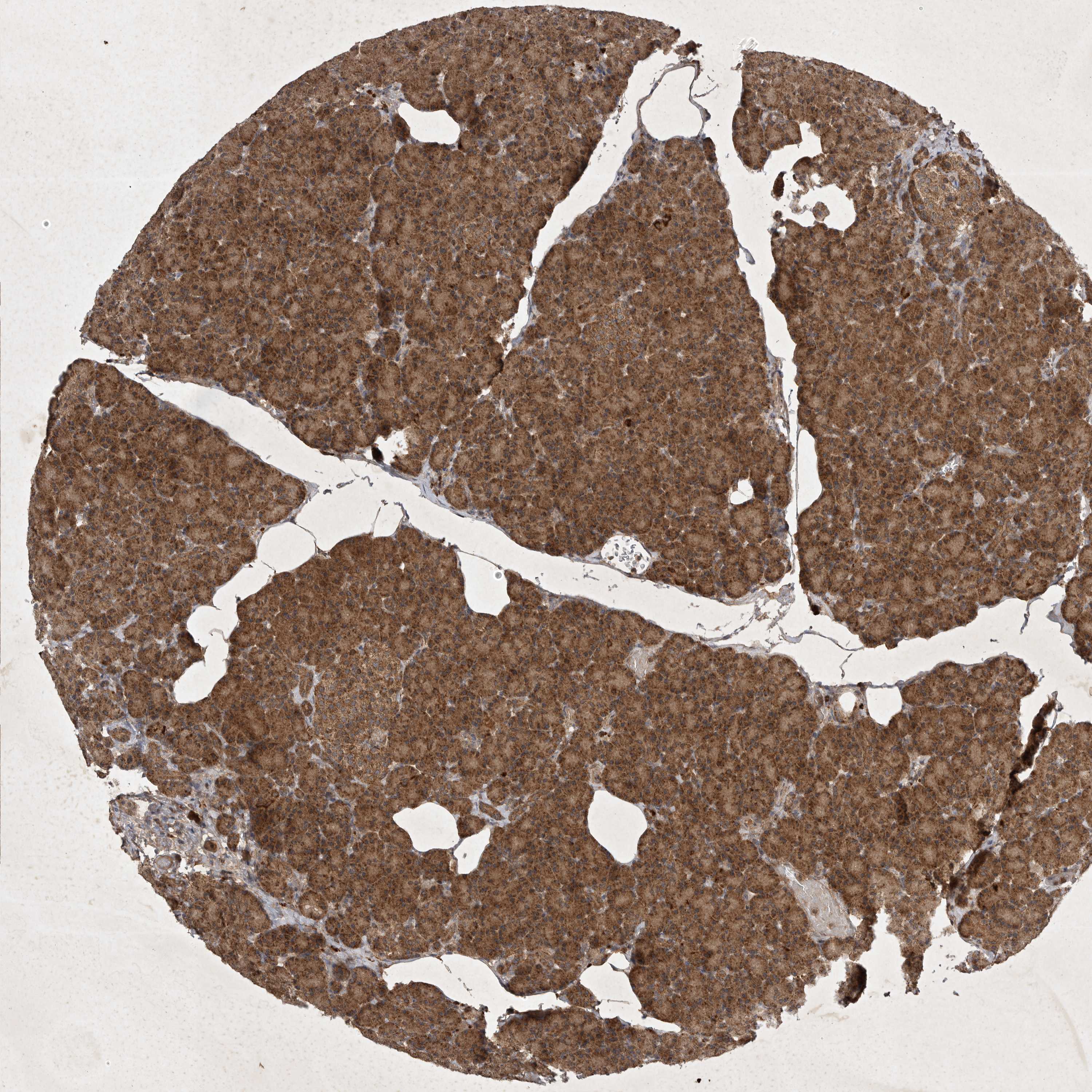 Tissue expression of DDR1 Staining in pancreas The Human Protein Atlas