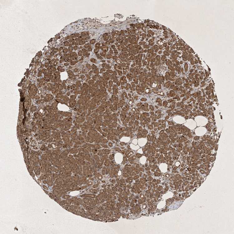 Tissue expression of DDR1 Staining in pancreas The Human Protein Atlas