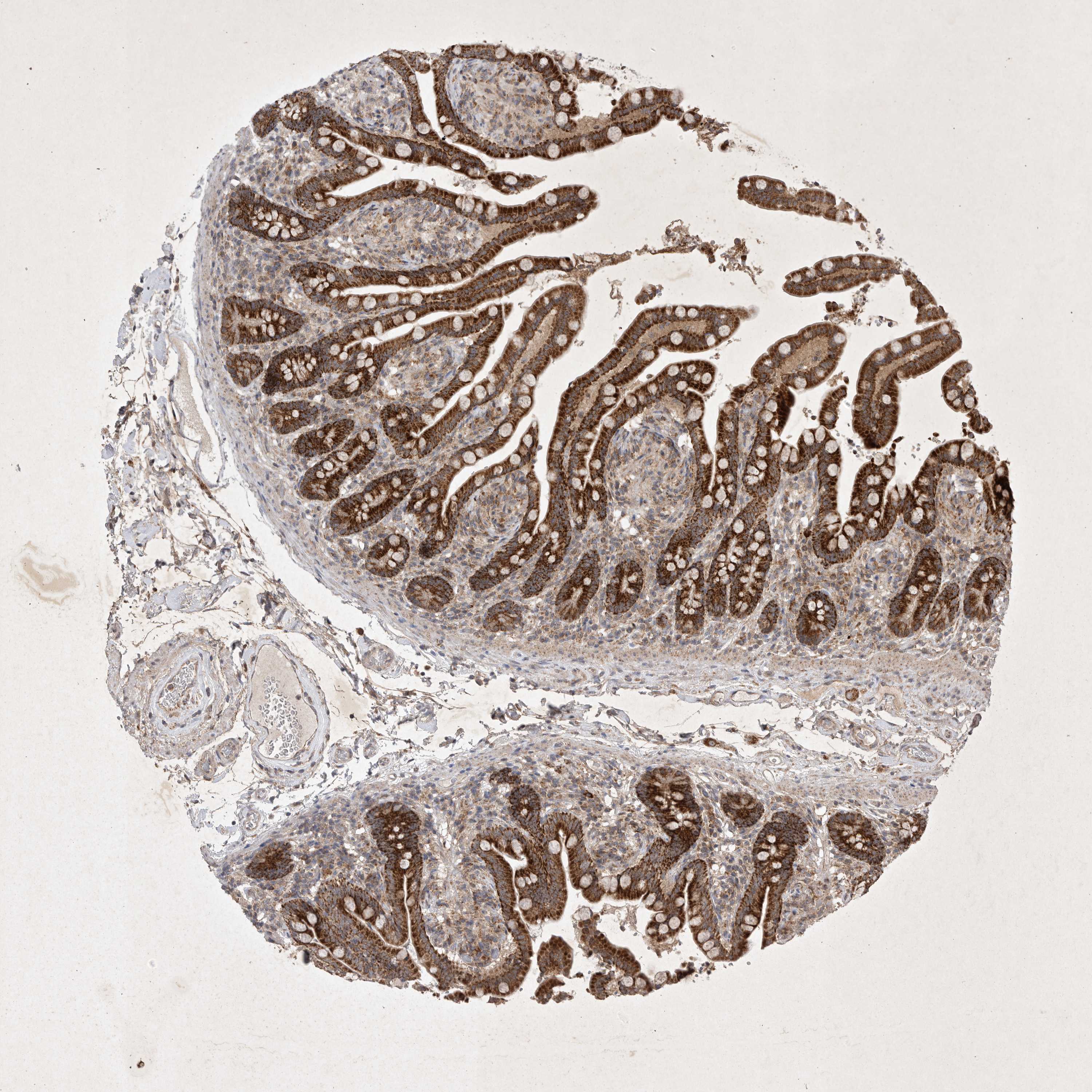 Tissue expression of DDR1 Staining in colon The Human Protein Atlas