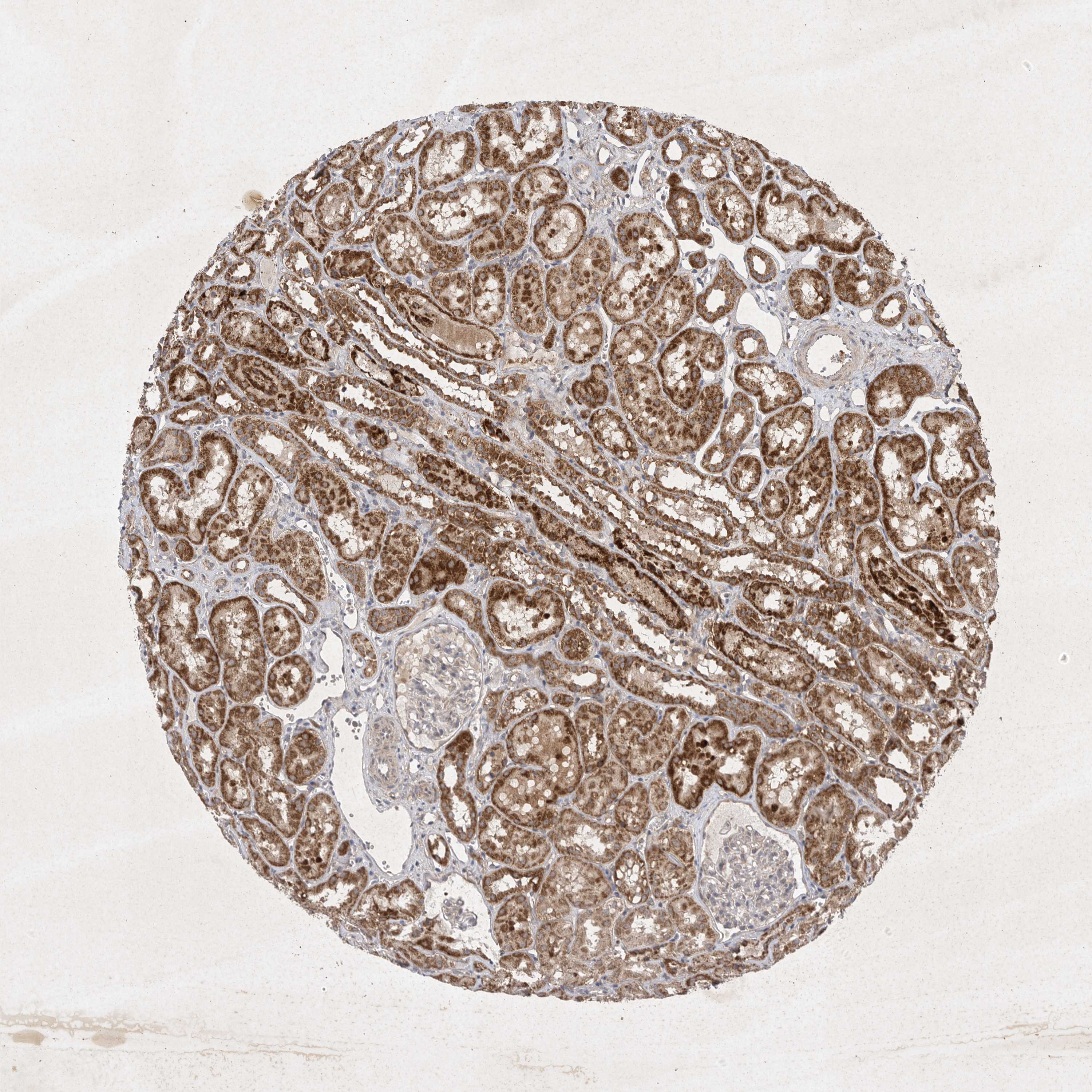 Tissue expression of DDR1 Staining in kidney The Human Protein Atlas
