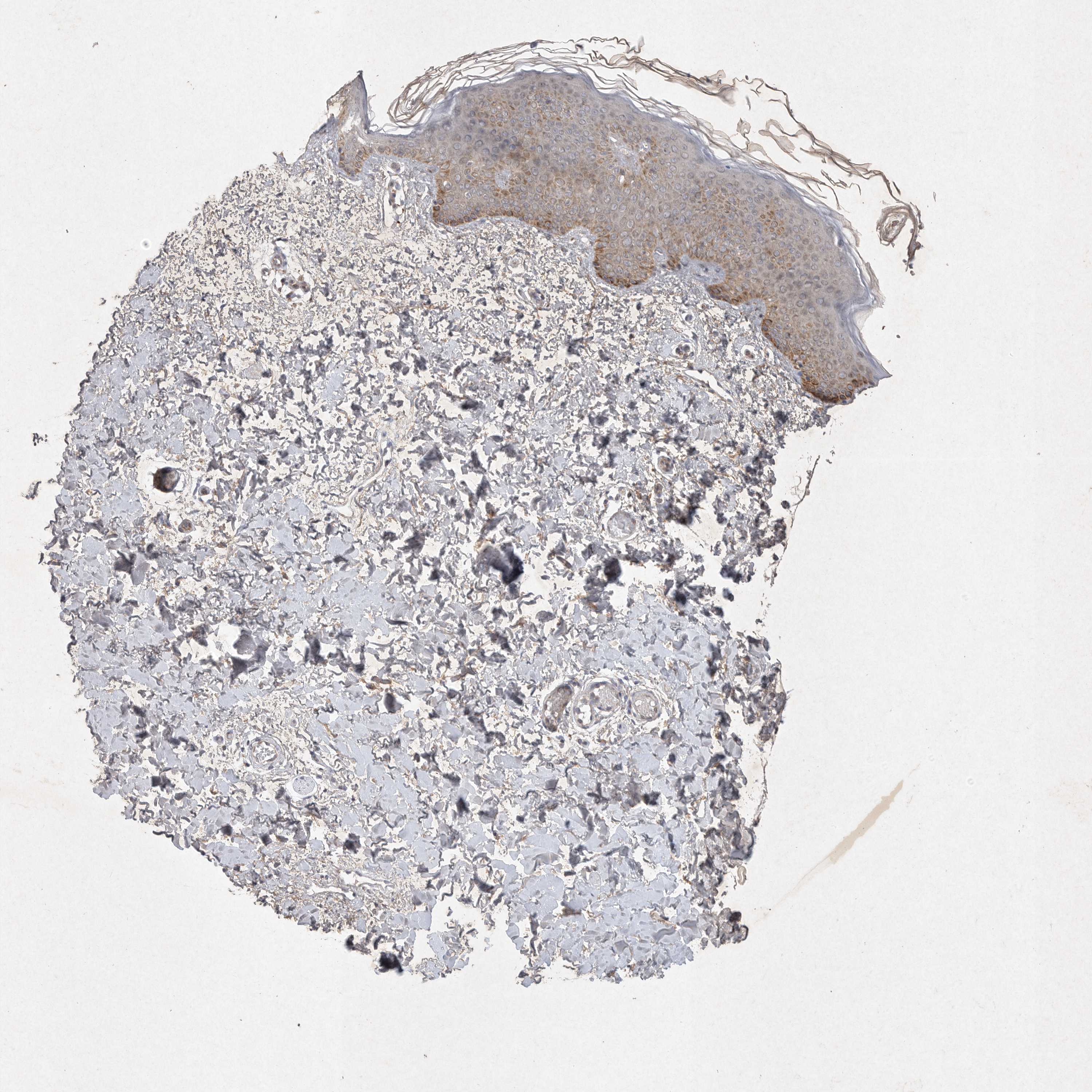 Tissue expression of DDR1 Staining in skin The Human Protein Atlas